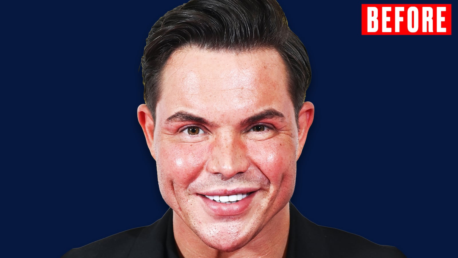 Explore Bobby Norris before and after his facelift at 39, including his transformation, health scare, and public reaction.