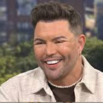 Bobby Norris reveals his new face after surgery and discusses future procedures, past filler use, and a life-changing health scare.