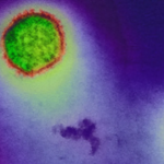 A clear explainer on the MV Hondius hantavirus outbreak, who was affected, how the virus may have spread, and why public risk remains low.