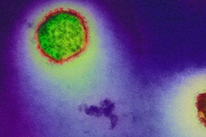 A clear explainer on the MV Hondius hantavirus outbreak, who was affected, how the virus may have spread, and why public risk remains low.