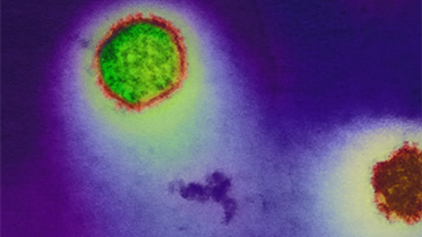 A clear explainer on the MV Hondius hantavirus outbreak, who was affected, how the virus may have spread, and why public risk remains low.