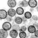 Learn about hantavirus symptoms, causes, and the deadly cruise ship outbreak near Cape Verde affecting passengers and global health.