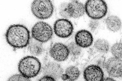 Learn about hantavirus symptoms, causes, and the deadly cruise ship outbreak near Cape Verde affecting passengers and global health.