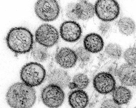 Learn about hantavirus symptoms, causes, and the deadly cruise ship outbreak near Cape Verde affecting passengers and global health.