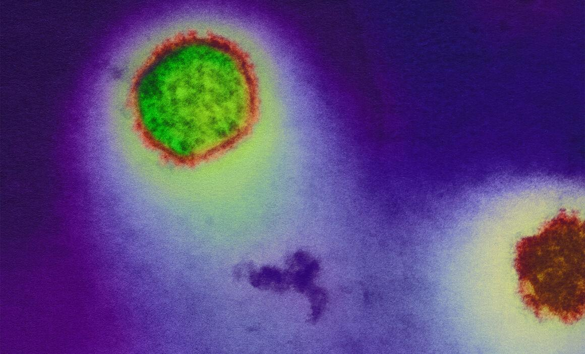 Learn about hantavirus symptoms, causes, and the deadly cruise ship outbreak near Cape Verde affecting passengers and global health.