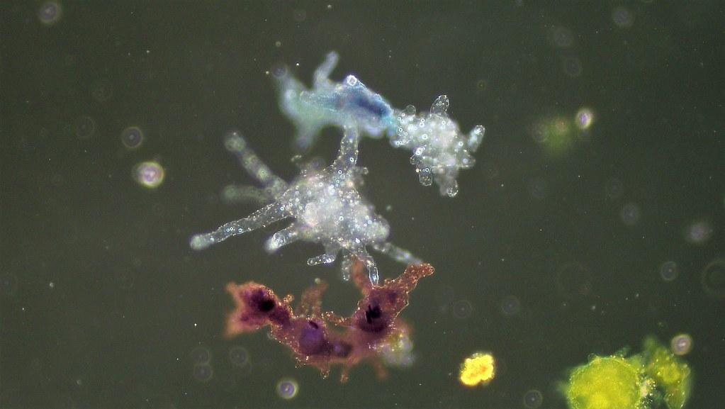Learn what amoebae are, how they function, and why some species pose serious global health risks.