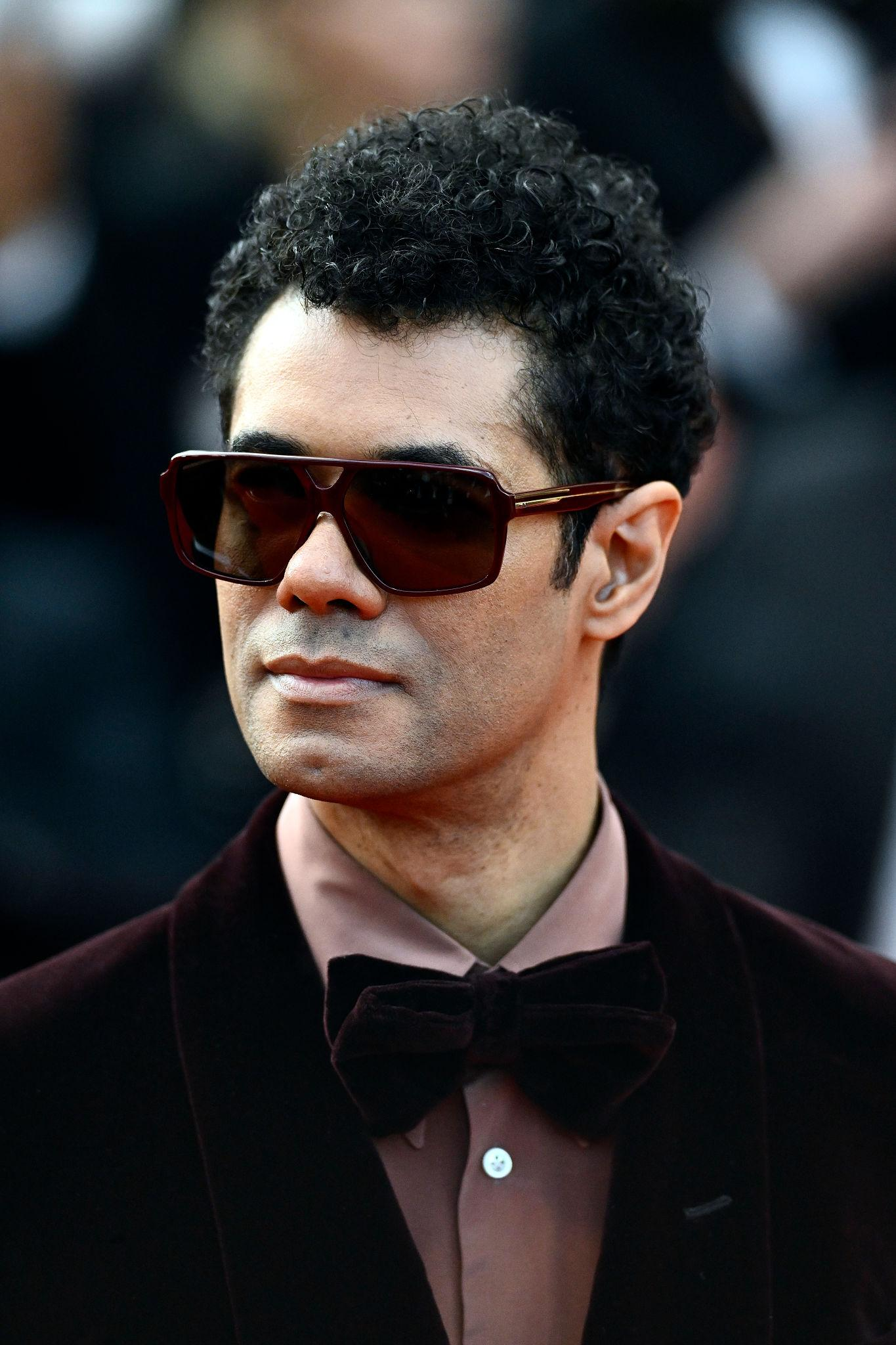 Richard Ayoade was caught up in an East Dulwich crash that injured two women, as police investigate and his busy TV career continues.